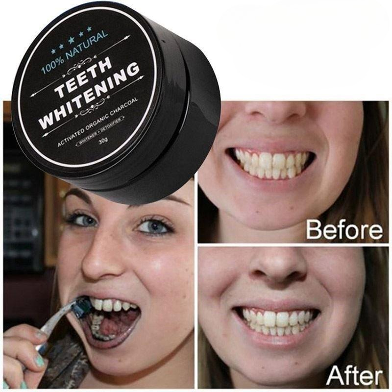 1 Box Activated Charcoal Teeth - đánh giá và giá Teeth Whitening Pens
