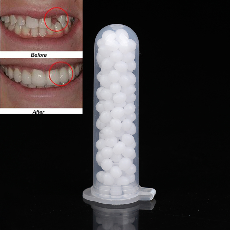 【K】1Box Temporary Tooth Repair - đánh giá và giá Teeth Whitening Kit