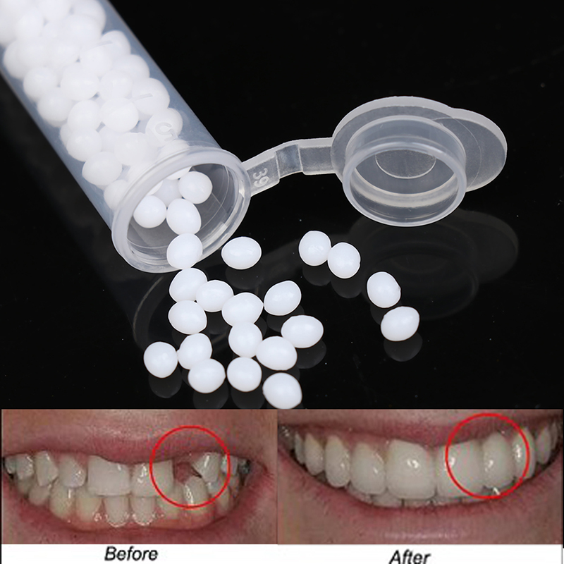 【K】1Box Temporary Tooth Repair - đánh giá và giá Teeth Whitening Kit